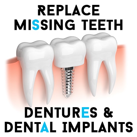 Replace Missing Teeth – Dentures & Dental Implants